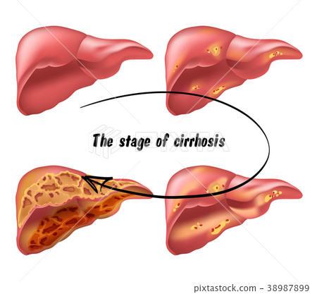 medical structure of the liver medical structure of the liver 38987899
