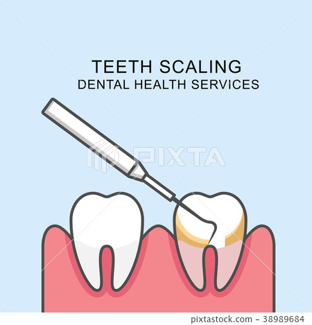 Teeth scaling icon - scaling tooth  38989684