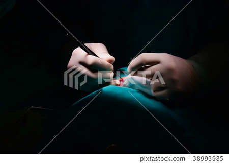 The doctor is performing cleft palate. The doctor is performing cleft palate. 38993985