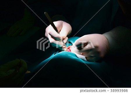 The doctor is performing cleft palate. The doctor is performing cleft palate. 38993986