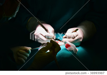 The doctor is performing cleft palate. The doctor is performing cleft palate. 38993987