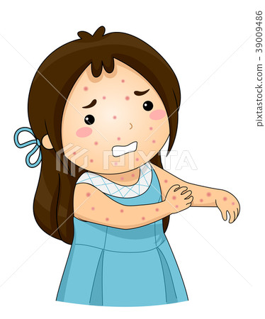 Kid Girl Chicken Pox Scratch Illustration - Stock Illustration ...