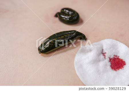 Leeches on his stomach in the liver area and the 39028129