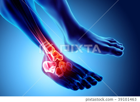 Ankle painful - skeleton x-ray. 39101463