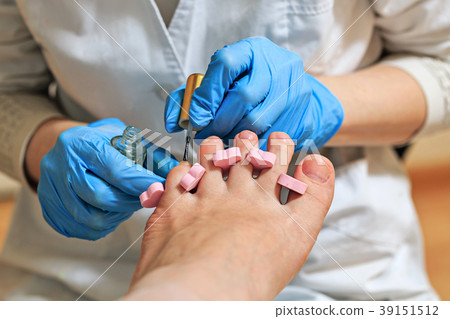 Chiropody Chiropody 39151512