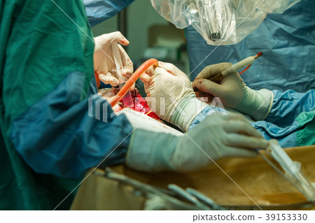hands of surgeons with tools. 39153330