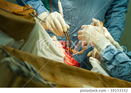 hands of surgeons with tools. 39153332