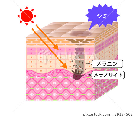 Skin sectional view sunburn stain Skin sectional view sunburn stain 39154502