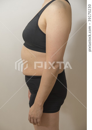 Female left side before diet 39170230