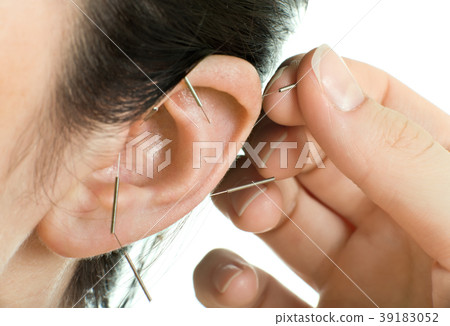acupuncture acupuncture 39183052