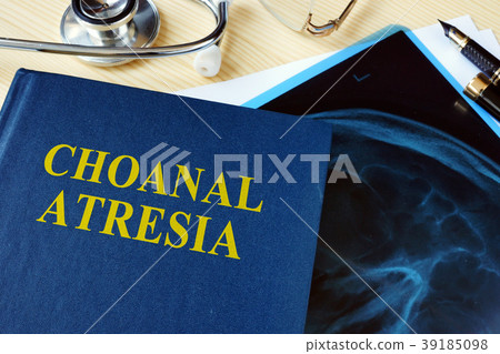 Book about Choanal Atresia on a hospital desk. Book about Choanal Atresia on a hospital desk. 39185098