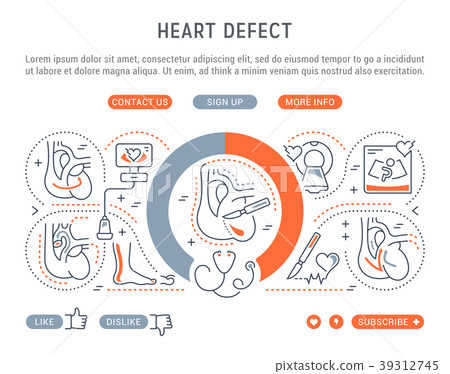 Website Banner and Landing Page of Heart Defect. 39312745