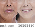 在鼻子之後的美麗形象之前 39393410