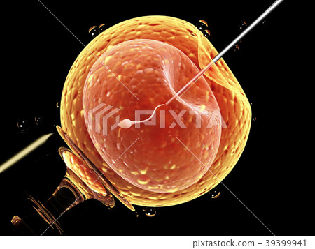 Artificial insemination Artificial insemination 39399941