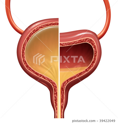Bladder Normal And Overactive Condition 39422049