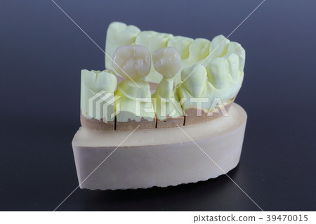 CAD / CAM crown 2 CAD / CAM crown 2 39470015
