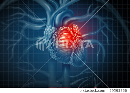Heart Attack 39593866