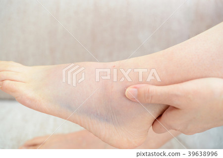 遭受扭傷的腿的婦女 遭受扭傷的腿的婦女 39638996
