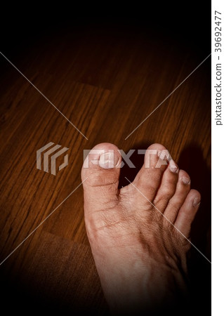 Cracks on the toenail. Cracks on the toenail. 39692477