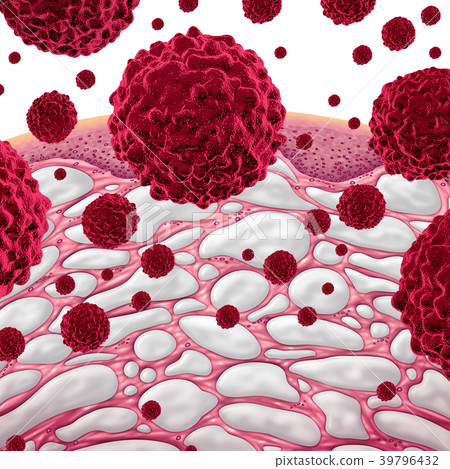 Interstitium And Cancer 39796432