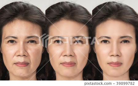 Anti Aging process, Asian woman face skin. Anti Aging process, Asian woman face skin. 39899782