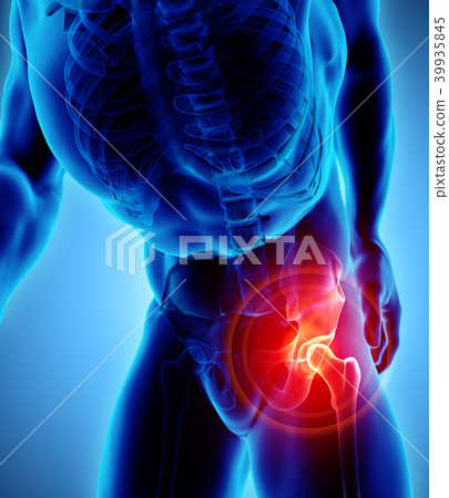Hip painful skeleton x-ray, 3D illustration. 39935845