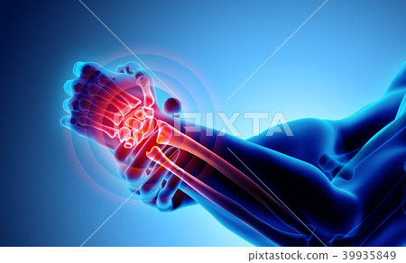 Wrist painful - skeleton x-ray. Wrist painful - skeleton x-ray. 39935849