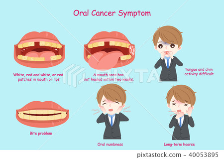 businessman with oral cancer businessman with oral cancer 40053895