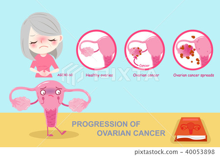 woman with uterine 40053898