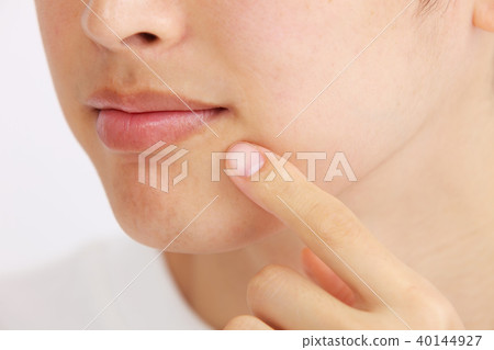 Men's Beauty Men's Esthetic Men's Cosmetic Skin There are acne Men's Beauty Men's Esthetic Men's Cosmetic Skin There are acne 40144927