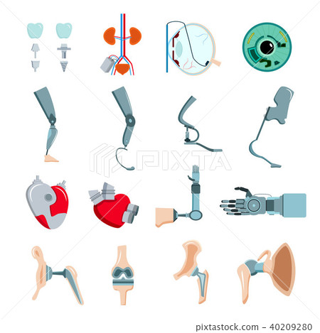 Prothesis Implants Flat Set 40209280