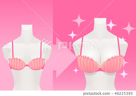 Illustration of bust up before after Illustration of bust up before after 40225393