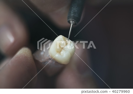 Dental Prosthesis 40279960