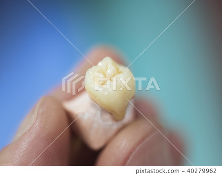 Dental Prosthesis Dental Prosthesis 40279962