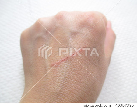 Hand cuts Hand cuts 40397380