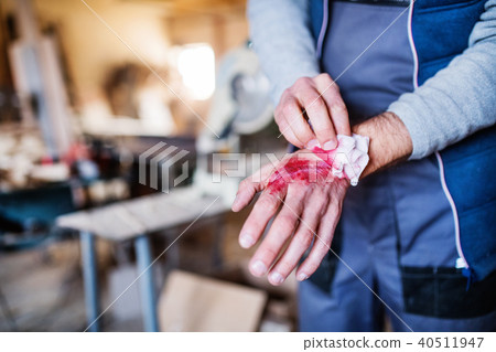 Man with an injured hand after accident at work in the carpentry workshop. 40511947