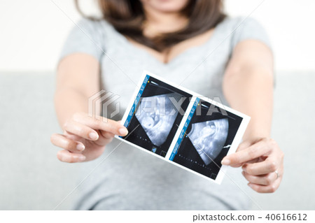 Pregnant woman sitting on sofa holding ultrasound. 40616612