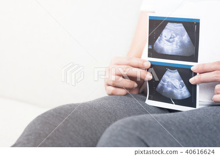 Blurry of happy pregnant woman holding ultrasound. 40616624