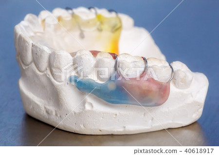 Colorful dental brace or retainer, clay gums model Colorful dental brace or retainer, clay gums model 40618917