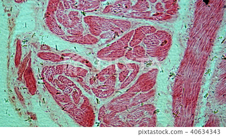Photomicrograph of smooth muscle Photomicrograph of smooth muscle 40634343