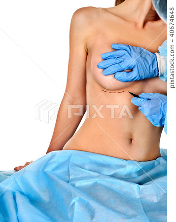 Breast surgery of body part. Implants for augmentation and bare nipples. 40674648
