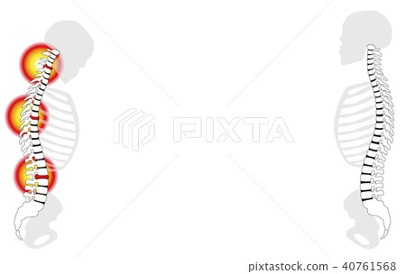 Back Problems Healthy Back Pain Slipped Disc Prola Back Problems Healthy Back Pain Slipped Disc Prola 40761568