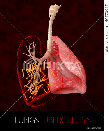 Bacteria Mycobacterium tuberculosis 40770047