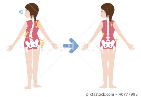 Chiropractic Before After - Stock Illustration [40777998] - PIXTA