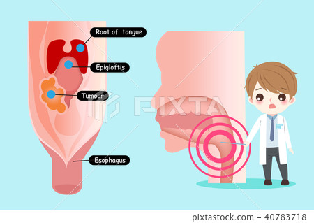doctor with oral cancer concept 40783718