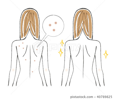 Before after acne marks on the back - Stock Illustration [40789825] - PIXTA