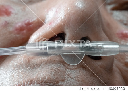 medication error effect on elderly patient medication error effect on elderly patient 40805630