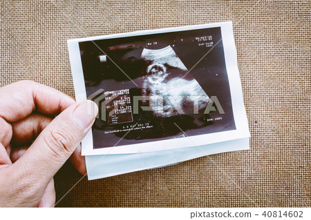 Photo of an ultrasound sonogram of an unborn baby 40814602