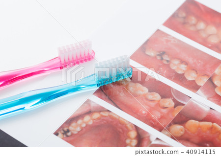 牙粉 牙粉 40914115