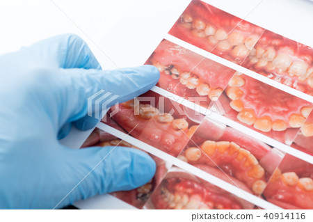 牙科檢查 牙科檢查 40914116